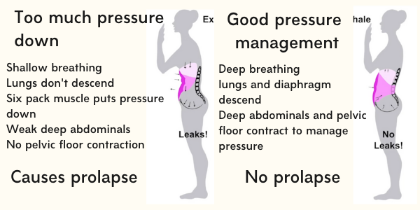 Prolapse and Pilates