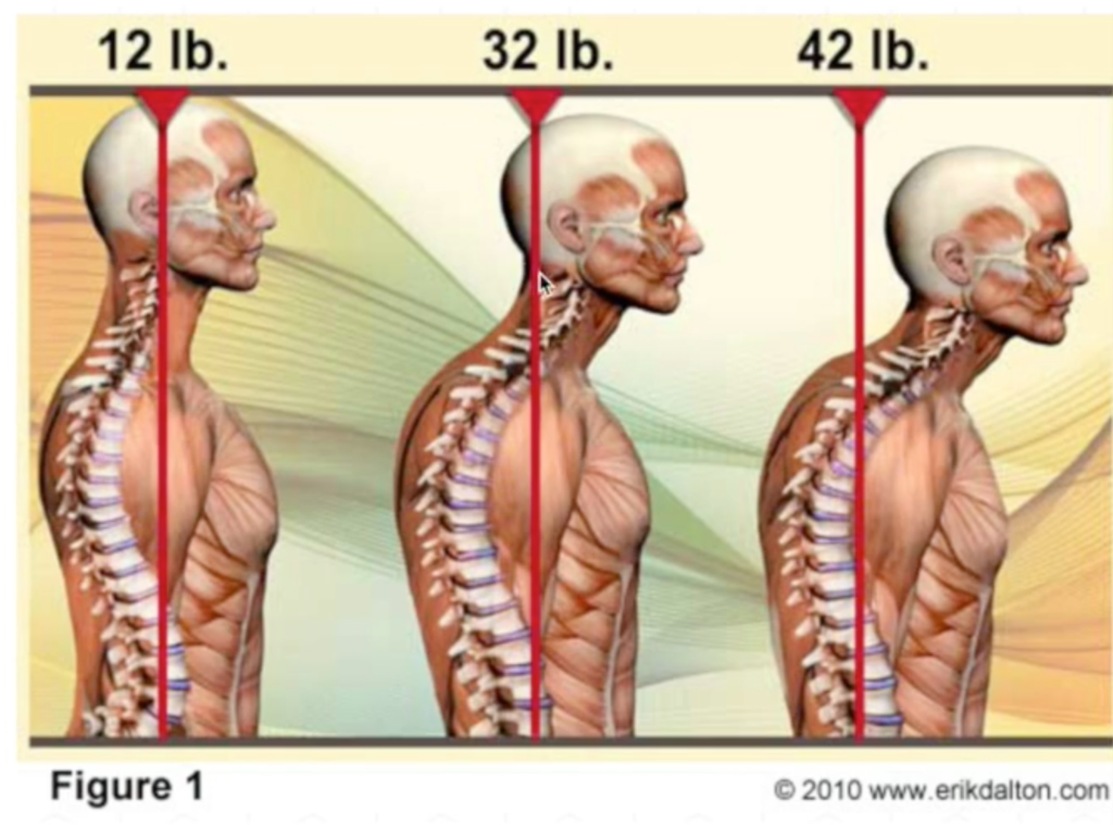 Neck pain and Pilates